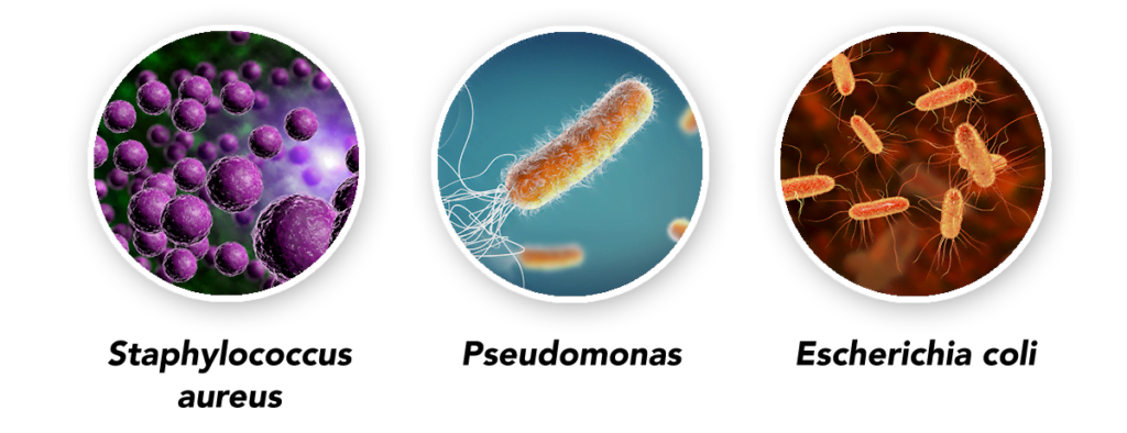 Durvet - Bumble Foot in Chickens - Bacteria